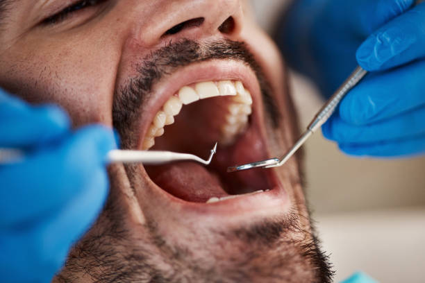 Best Emergency Dentist for Knocked-Out Tooth in Rainier, OR